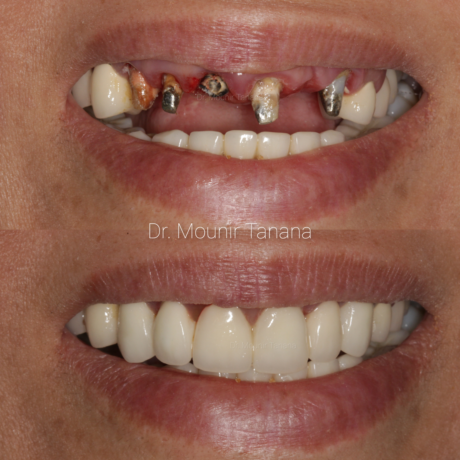 InCollage_20250925_221009665