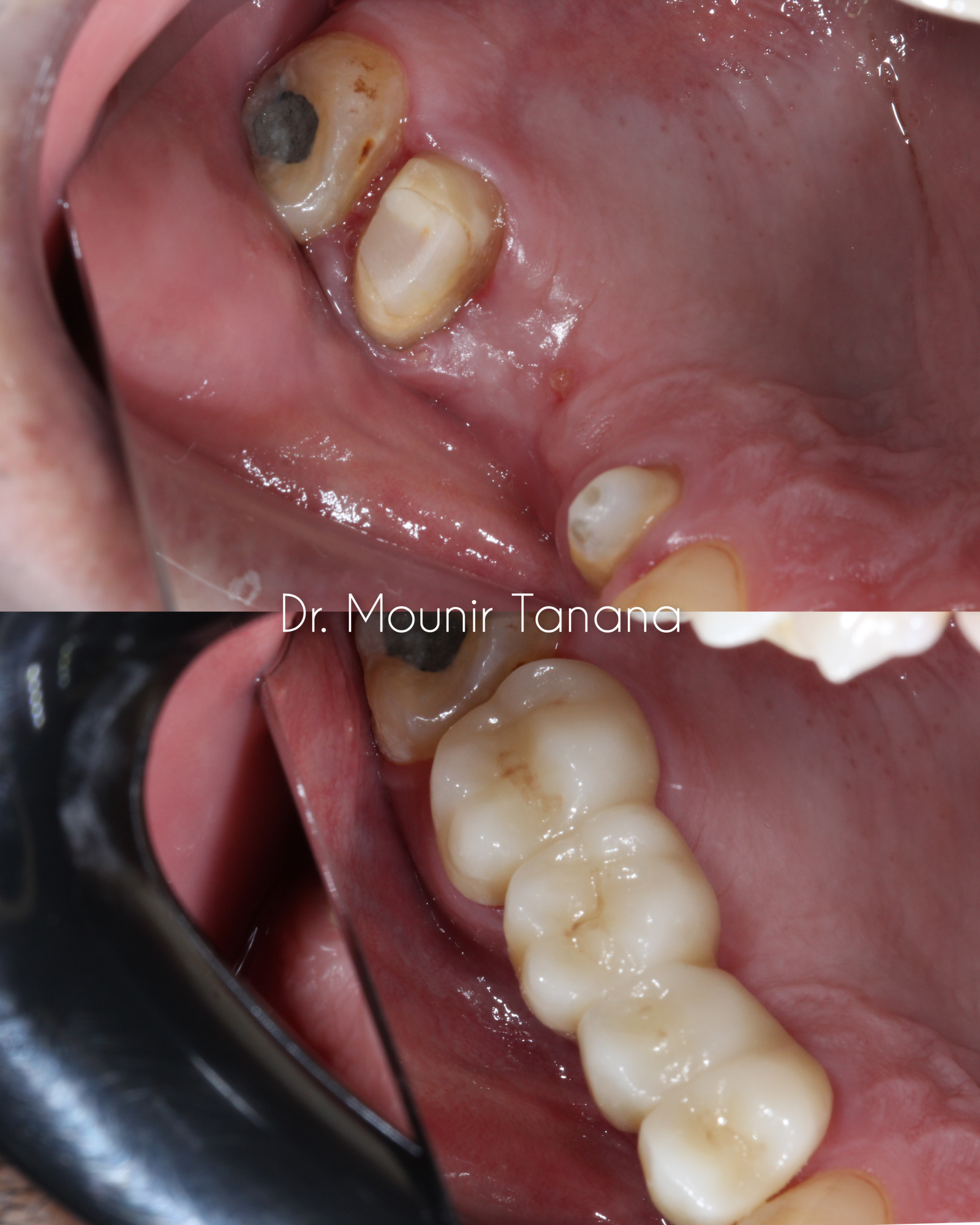 InCollage_20260111_160759586