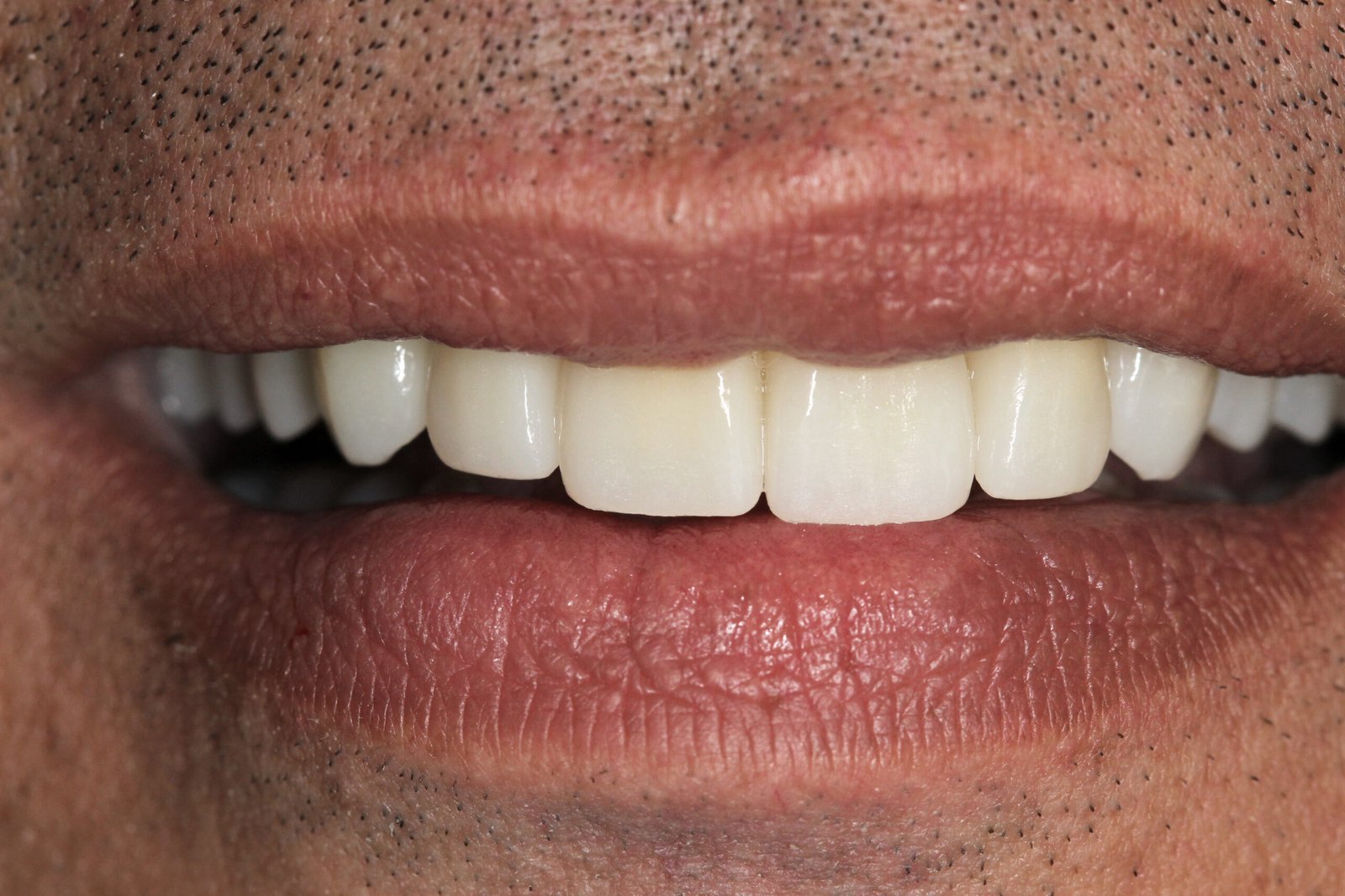 dentist hassan rabat dr mounir tanana